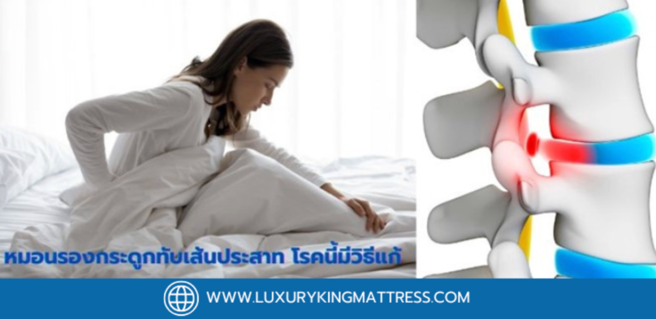 ที่นอนที่เหมาะสม สำหรับผู้ที่มีอาการหมอนรองกระดูกทับเส้น